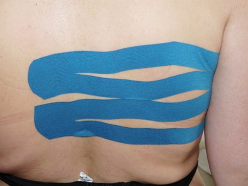 Pectoralis-Tape anlegen – Schritt-für-Schritt Anleitung