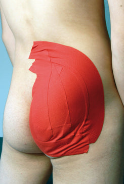 Glutaeus-Tape (Voll-Gluteus) anlegen – Schritt-für-Schritt Anleitung