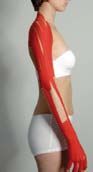 Lymphtape der oberen Extremitäten – Medi-Tape® Anwendung
