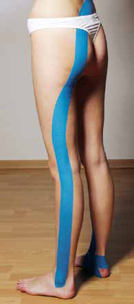 Blaues Kinesiology-Tape von der Hüfte bis zum Knöchel entlang des Ischiasnervs