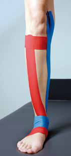 Rotes und blaues Kinesiology-Tape am Unterschenkel für Musculus tibialis anterior und posterior