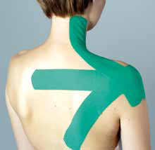 Kinesiology-Tape in Sternform auf Nacken und Schulter – Trapezius-Tape-Anwendung