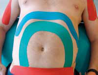 Grünes und rotes Kinesiology-Tape auf dem Bauch zur Beeinflussung der inneren Organe