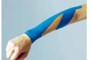 Tennisarm (Tennisellbogen) tapen – Schritt-für-Schritt-Anleitung